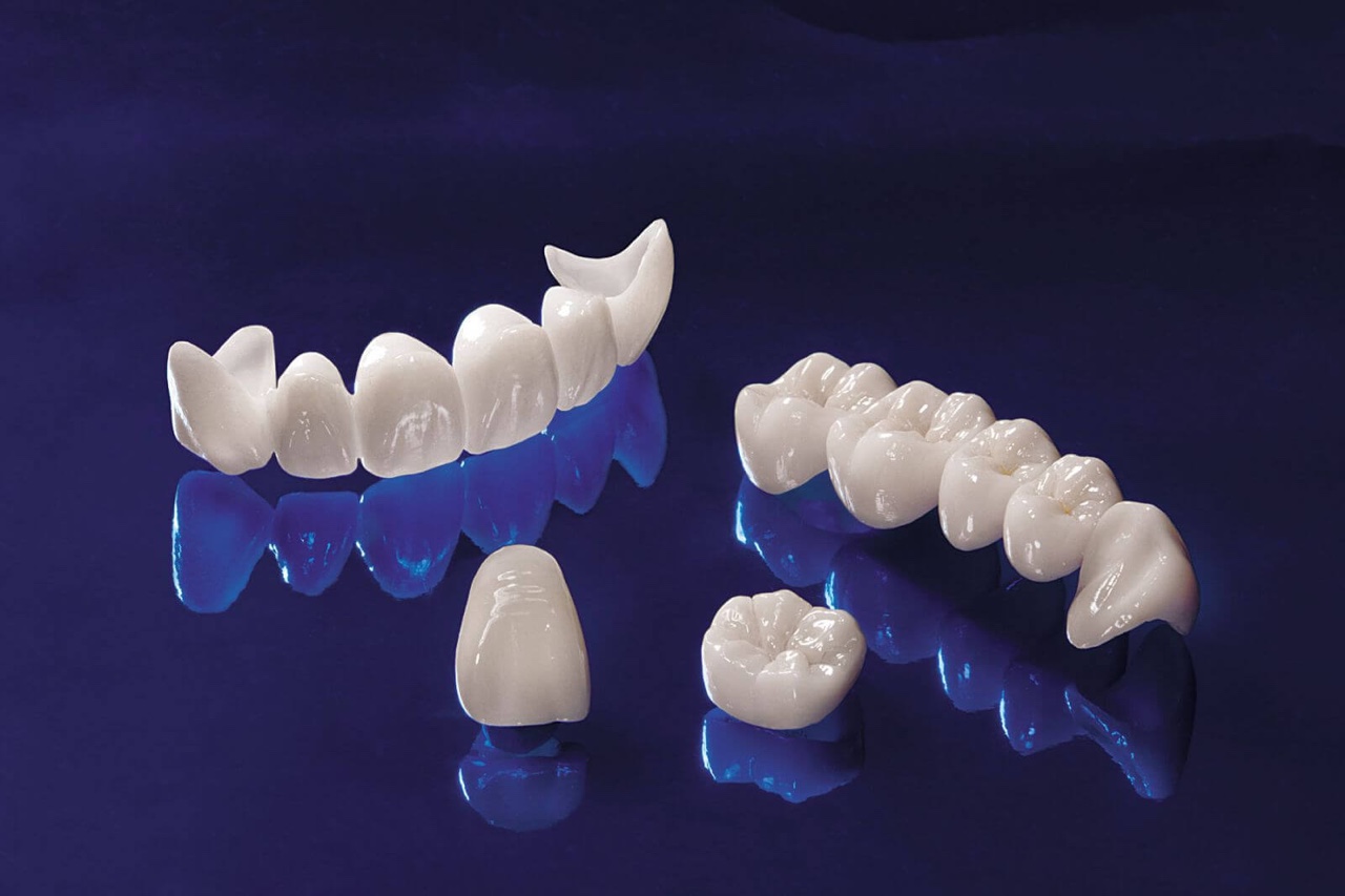 RĂNG SỨ ZIRCONIA